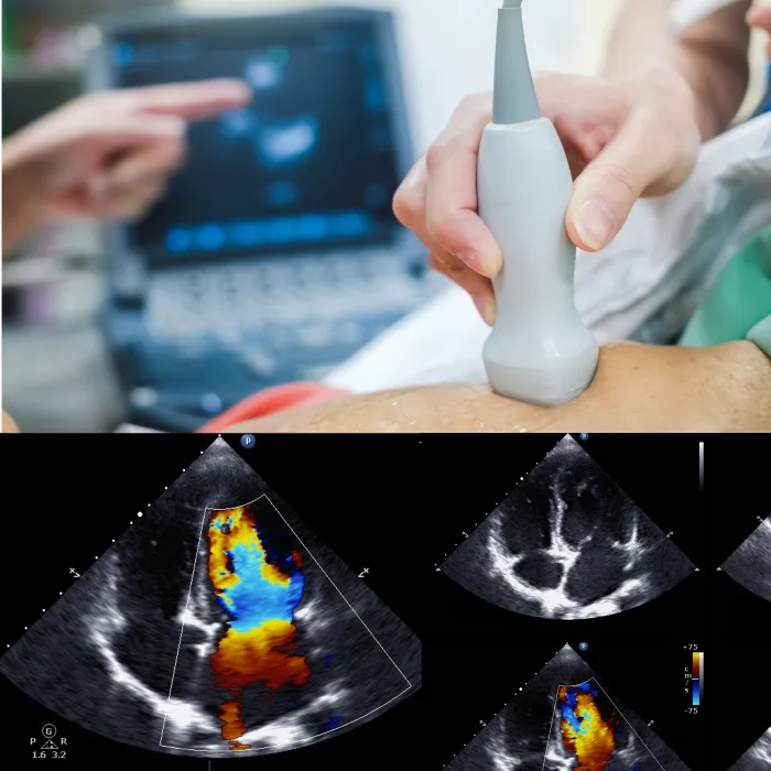 Ecocardiograma Doppler (en la semana)