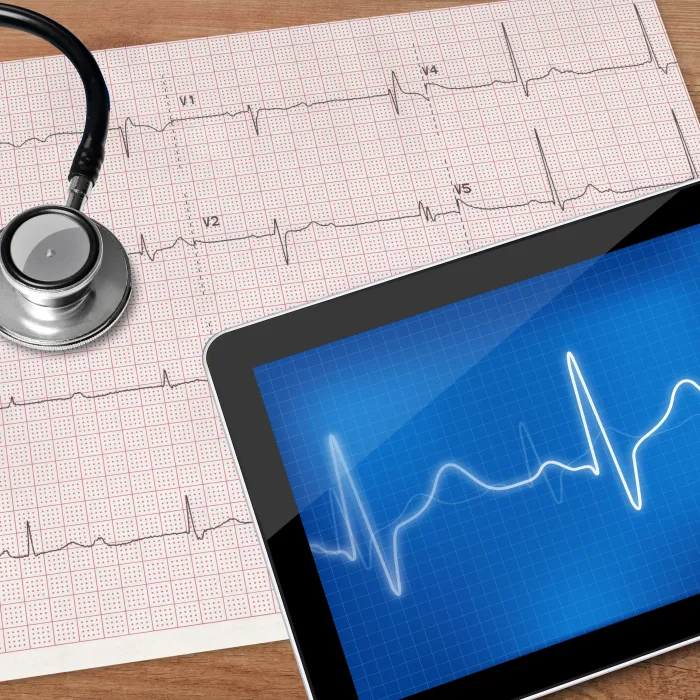 Electrocardiograma informado por Cardiólogo