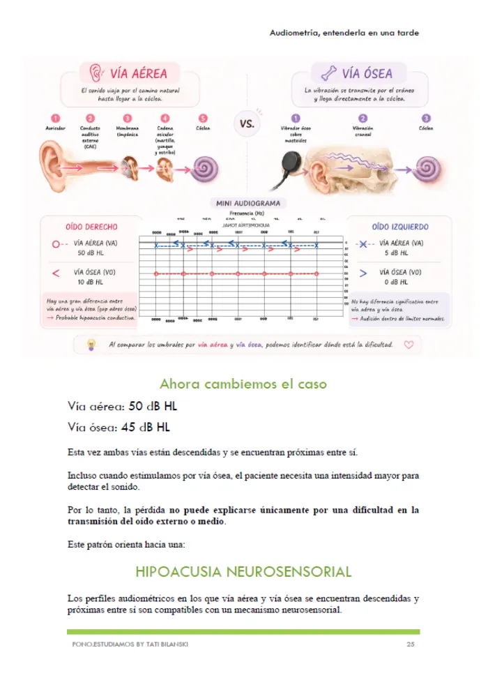 E-book AUDIOMETRIA TONAL 2