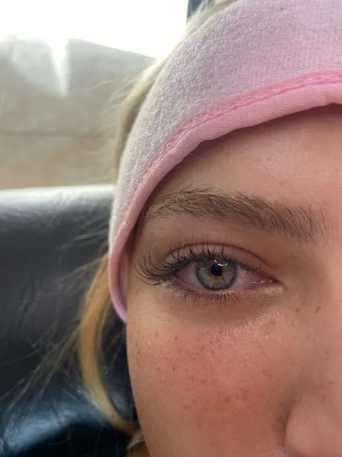 Efecto ojo alargado
