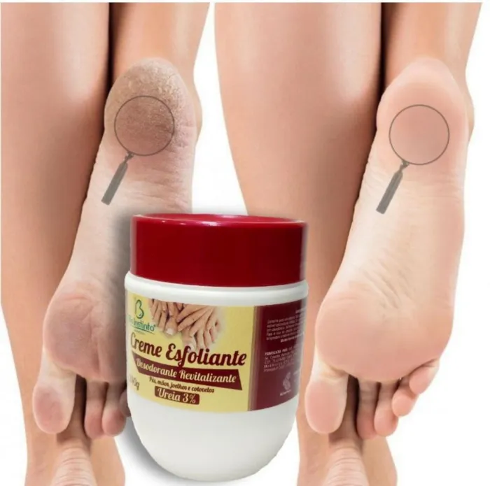 Crema exfoliante para pies y manos 