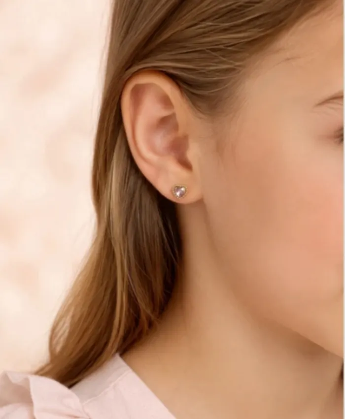 Aretes 
